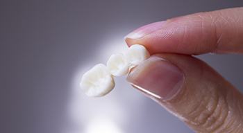a closeup of someone holding a dental bridge