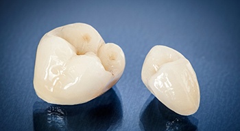 a closeup of metal-free dental crowns