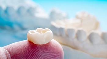 a closeup of a dental crown