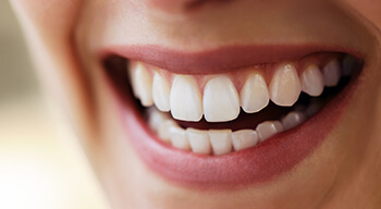 shot of smiling woman's teeth