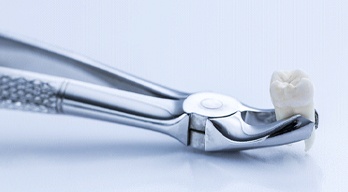 Forceps holding an extracted tooth 