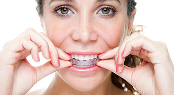 woman putting in invisalign