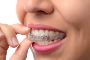 woman placing invisalign tray in her mouth 