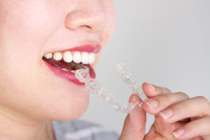 Woman putting in a clear tray