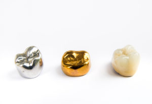 Three white, silver and gold dental crowns