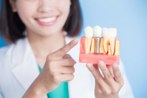 a patient during their dental implant consultation