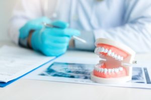 a dentist explaining why lower dentures slip using a model of dentures
